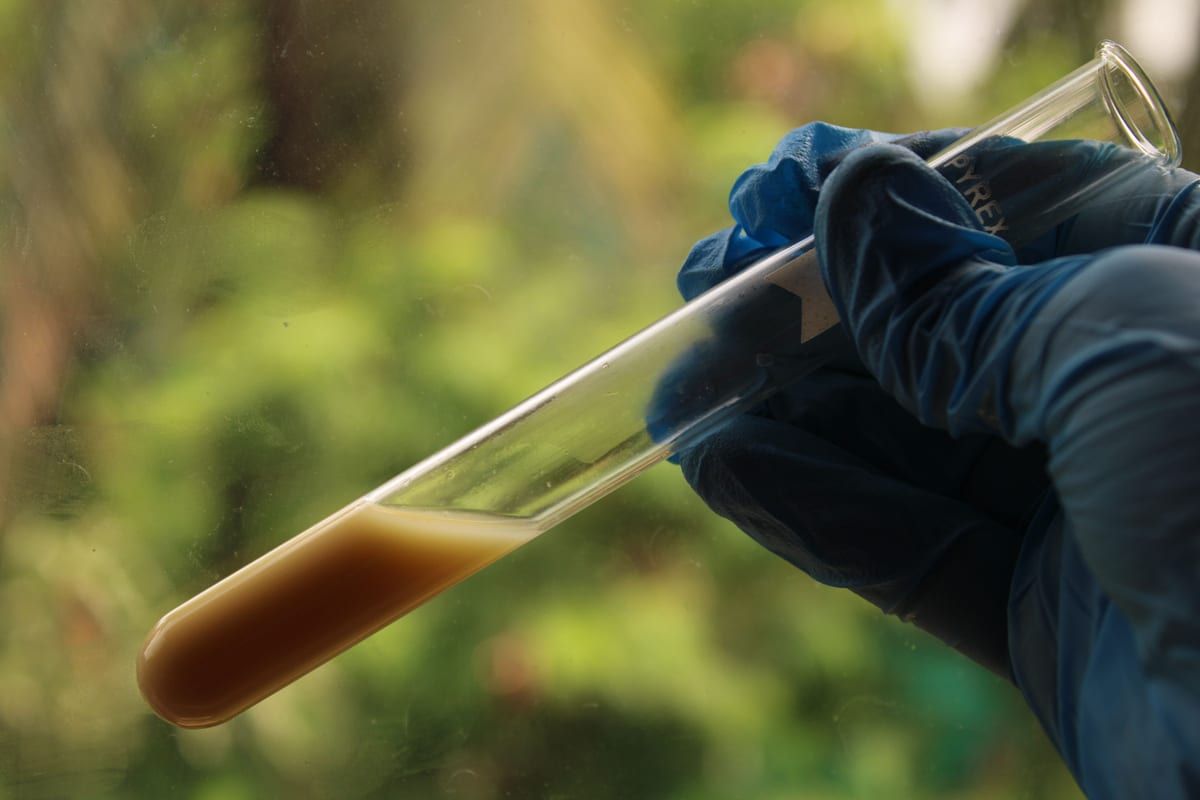 Stool Tests and SIBO: What They Can and Can't Show